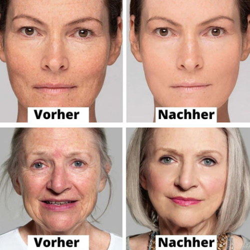 10+10 GRATIS | PuriMe™ | Waschfreie Kollagen-Straffungsmaske