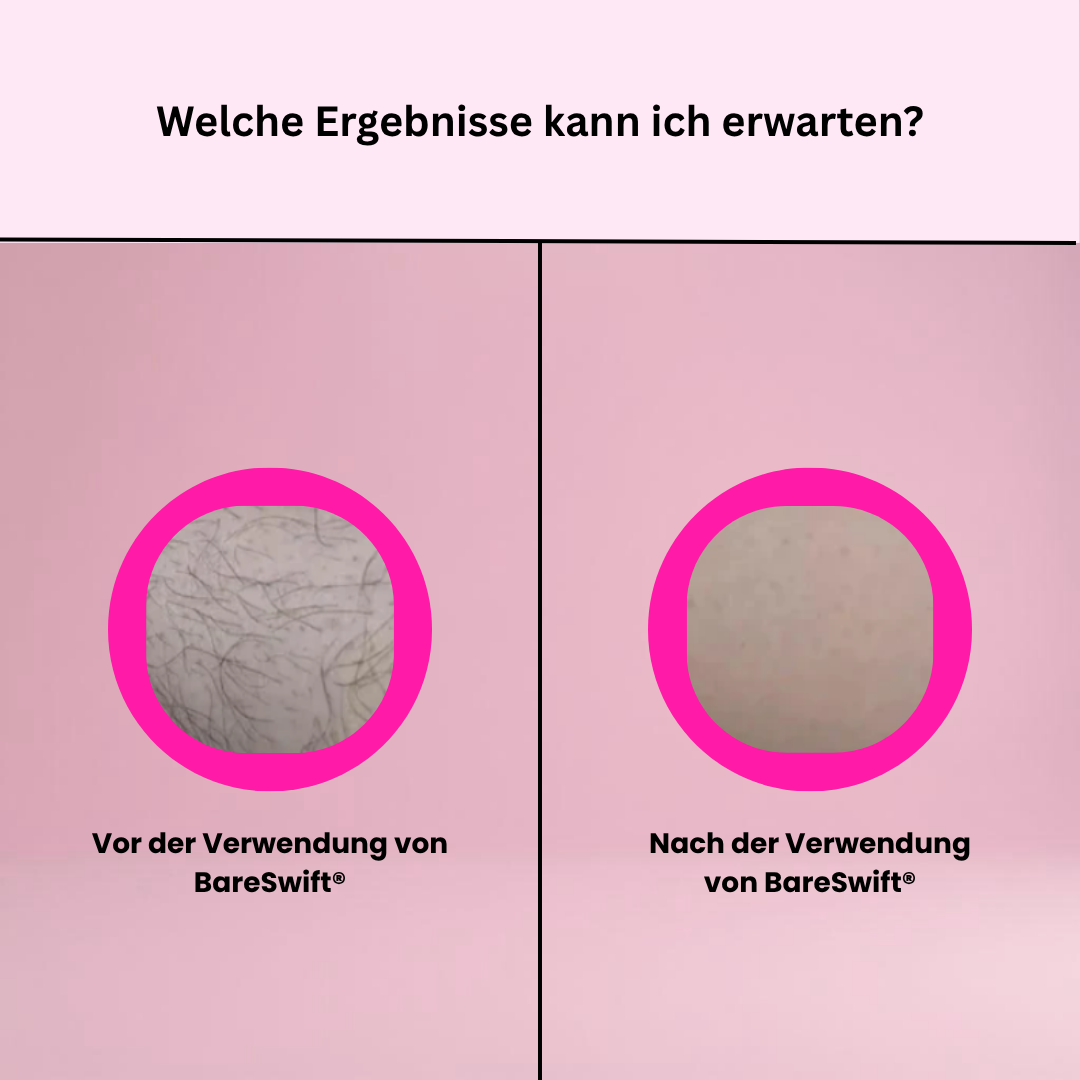 Elektrisches Haarentfernungsgerät in Rosa mit LCD-Display und ergonomischem Design – sanfter Damenrasierer für glatte Haut