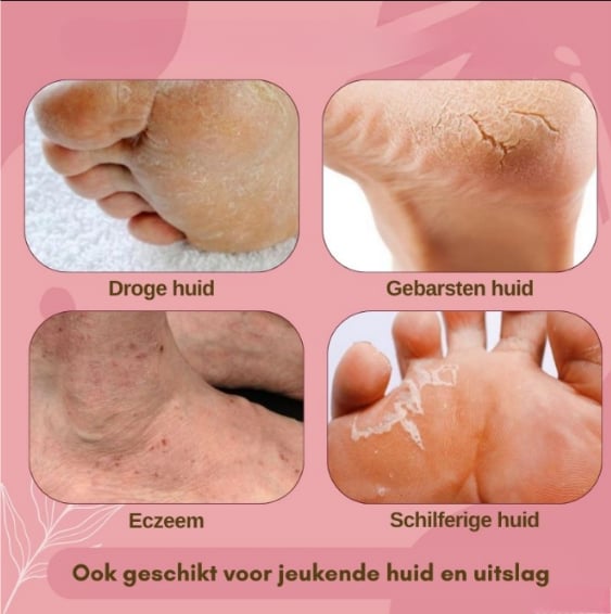 1+1 GRATIS | FootGlow™ - Voetherstellende crème