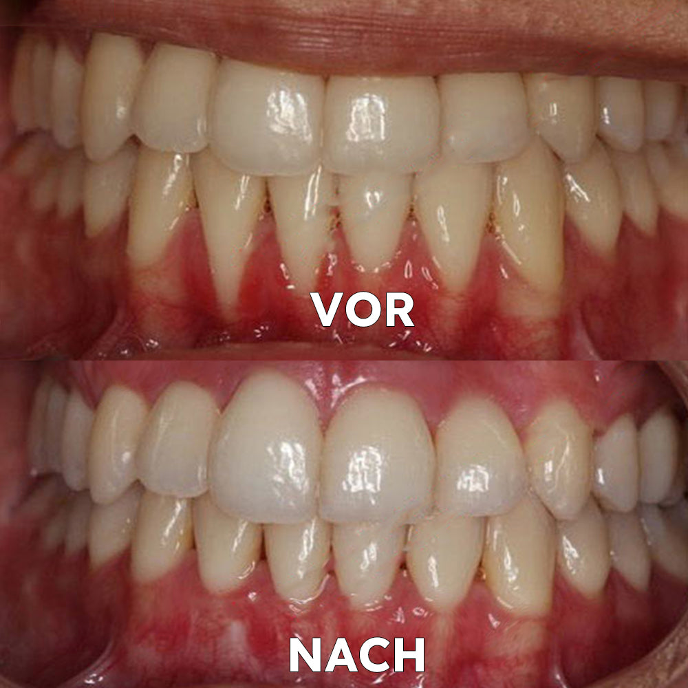CocoBreathe™ | Kokosöl-Mundspülung für frischen Atem und antibakterielle Wirkung