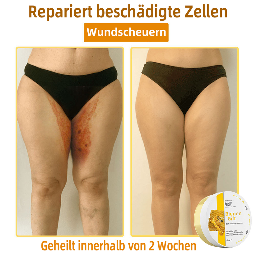 50% RABATT | ApisRelief™ | Natürliche Hautlösung