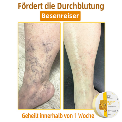 50% RABATT | ApisRelief™ | Natürliche Hautlösung
