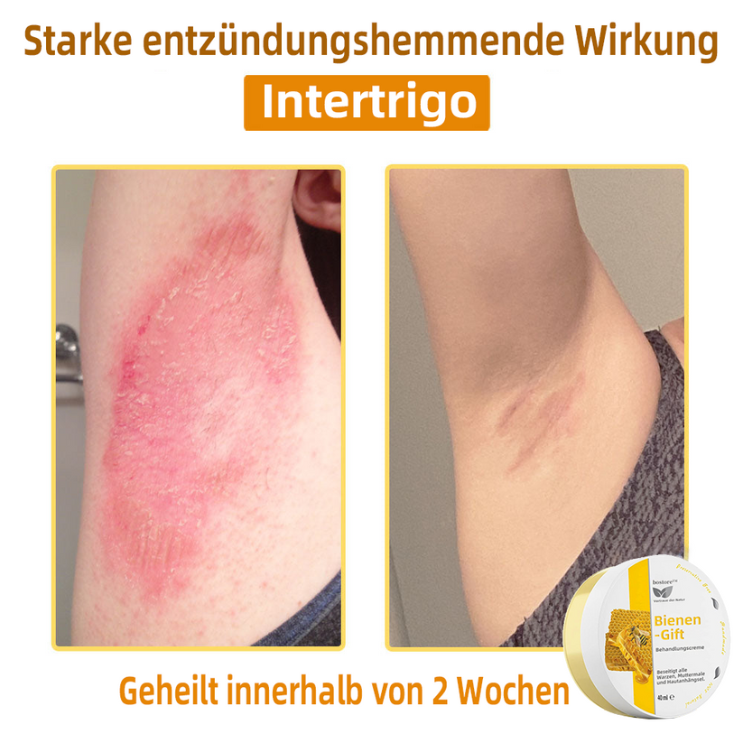 50% RABATT | ApisRelief™ | Natürliche Hautlösung