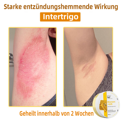 50% RABATT | ApisRelief™ | Natürliche Hautlösung