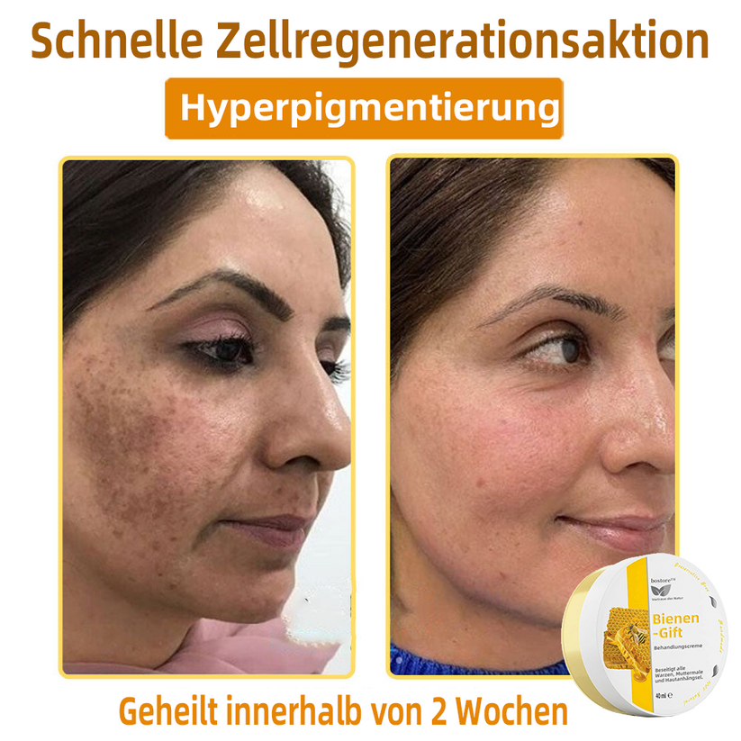 50% RABATT | ApisRelief™ | Natürliche Hautlösung