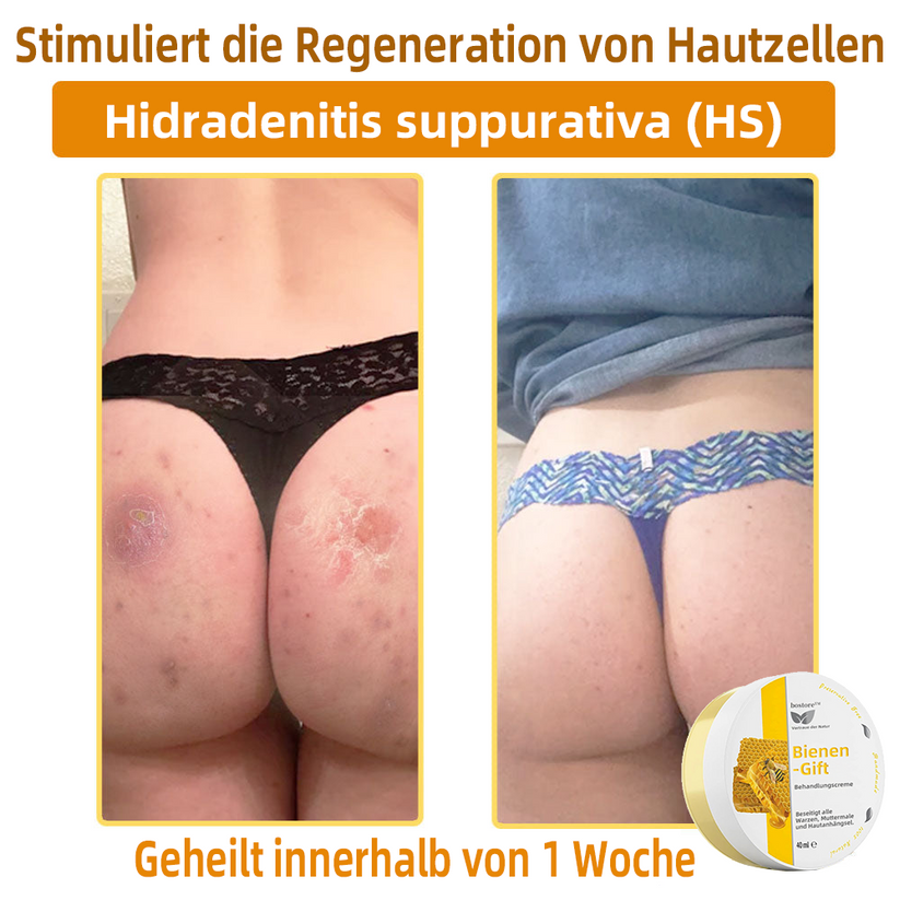 50% RABATT | ApisRelief™ | Natürliche Hautlösung