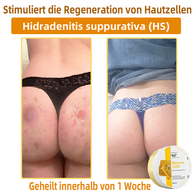 50% RABATT | ApisRelief™ | Natürliche Hautlösung