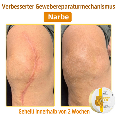 50% RABATT | ApisRelief™ | Natürliche Hautlösung