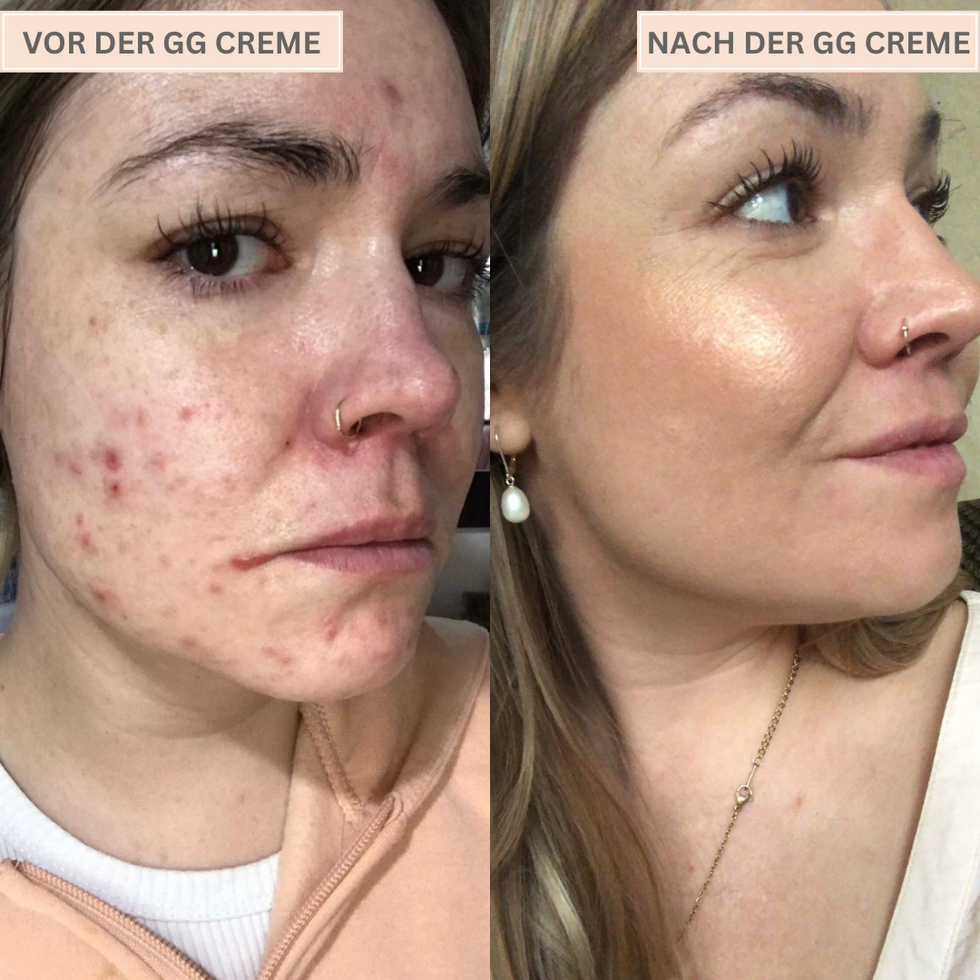 Glowelle™ | Strahlender Teint, ganz ohne Filter