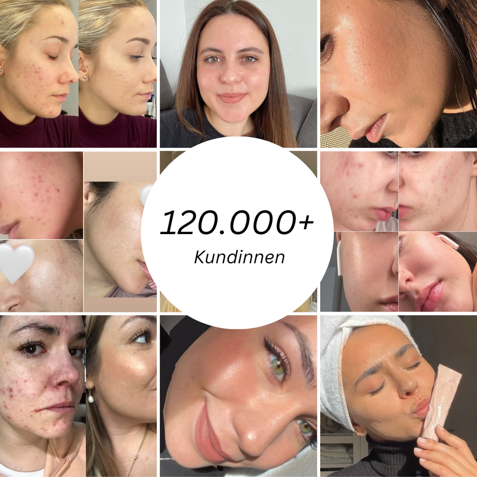 Glowelle™ | Strahlender Teint, ganz ohne Filter