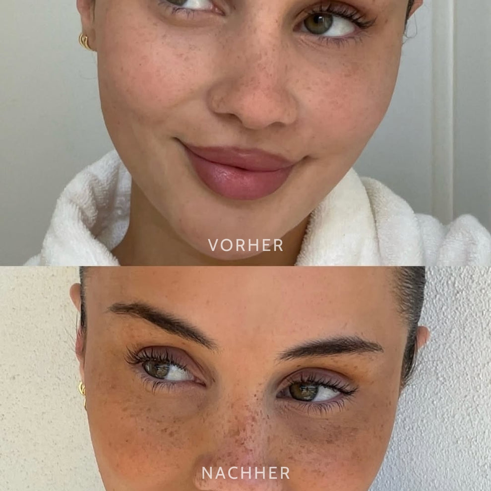 50% RABATT | Dottara™ | Einfach natürlicher Glow, ganz ohne Sonne!
