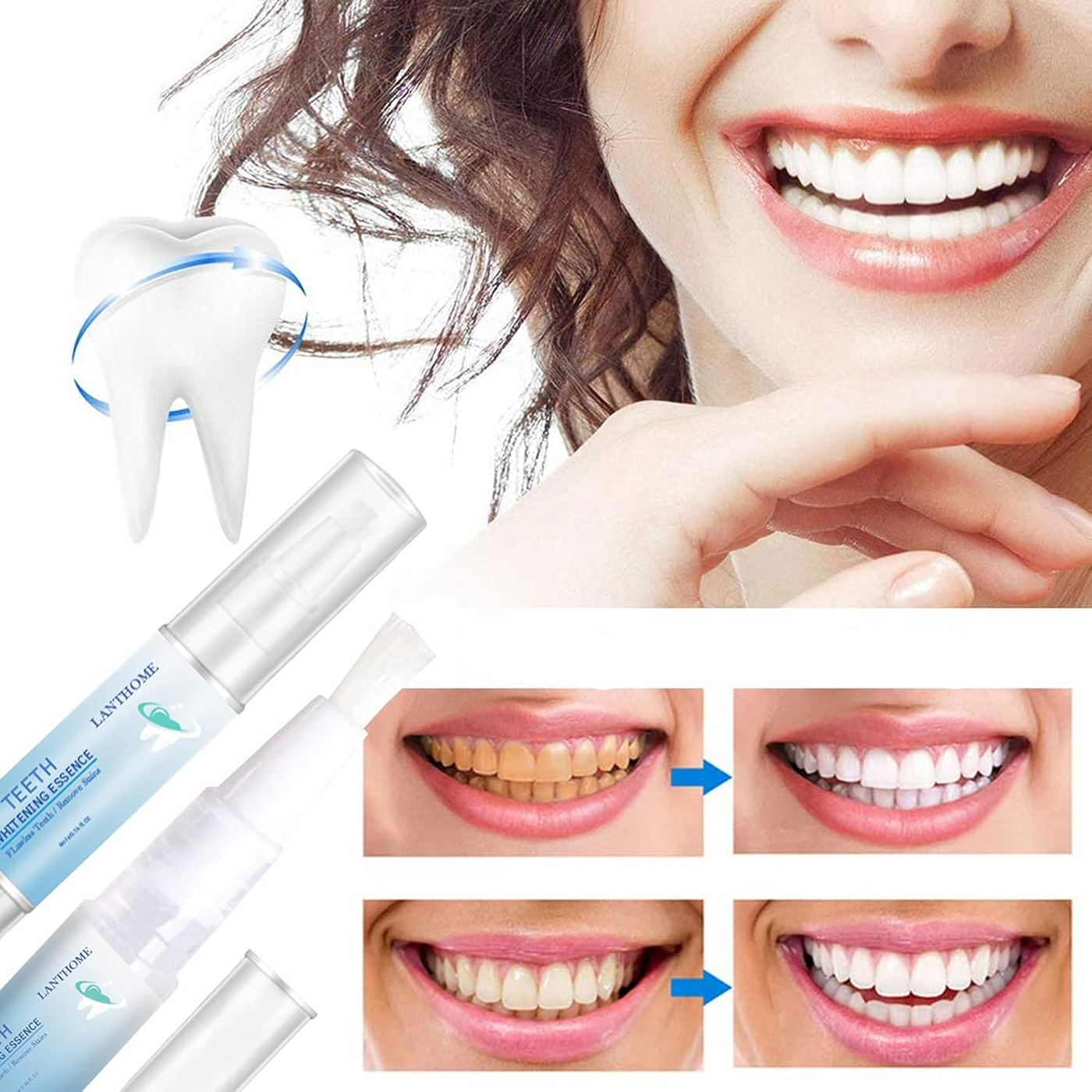 50% RABATT | TeethPro™ Zahnaufhellungs-Essenz