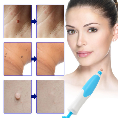 50% RABATT | Dermavex™ | Hautanhänger Entferner – Sanft & Wirksam