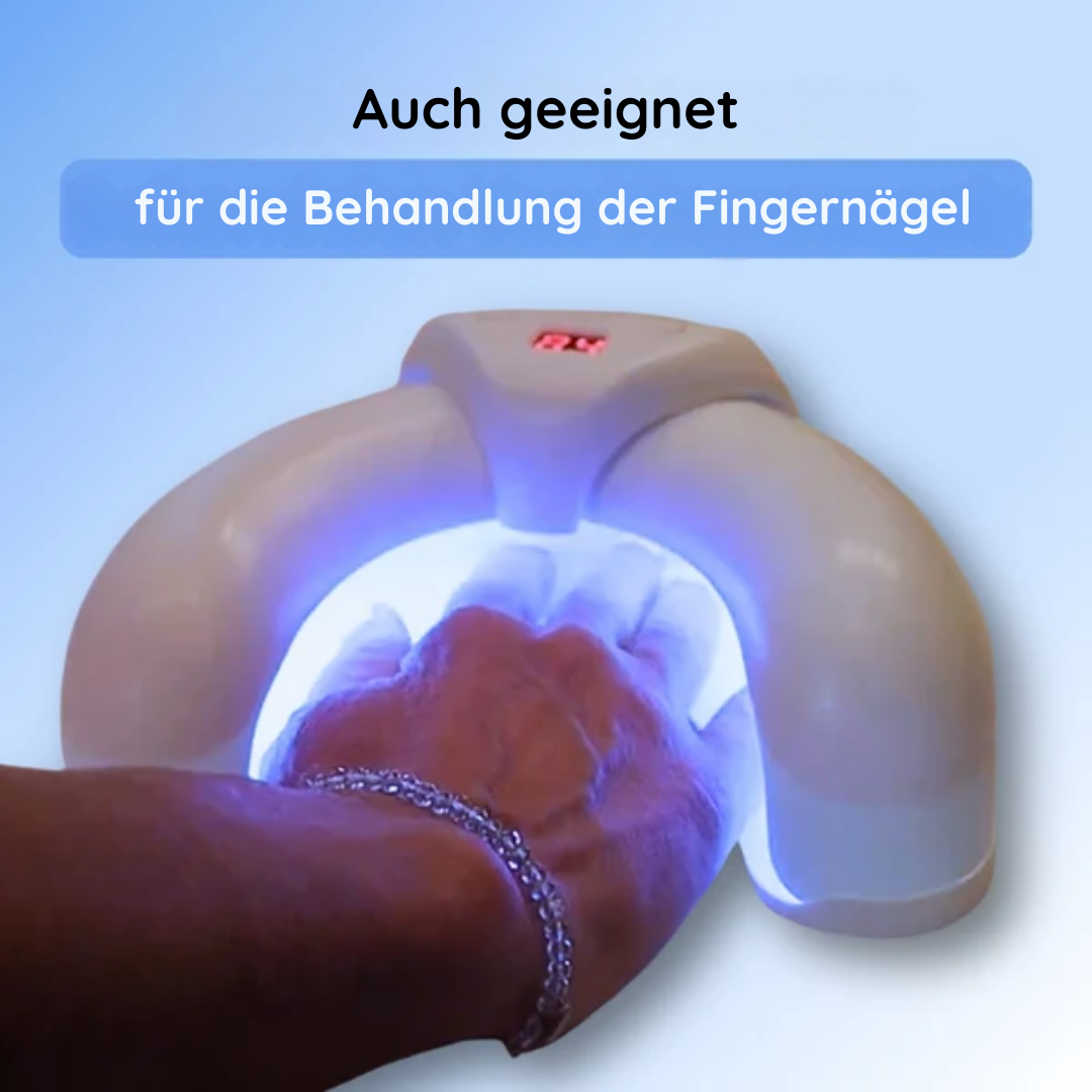 50% RABATT | ClearNail™ | Hausgebrauch, Medikamentenfrei, Nagelpilzlösung