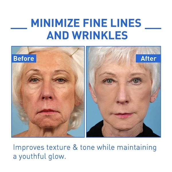 1+1 GRATIS | GlowTox™ | Glatte, jugendliche Haut mit Botox Anti-Aging Serum