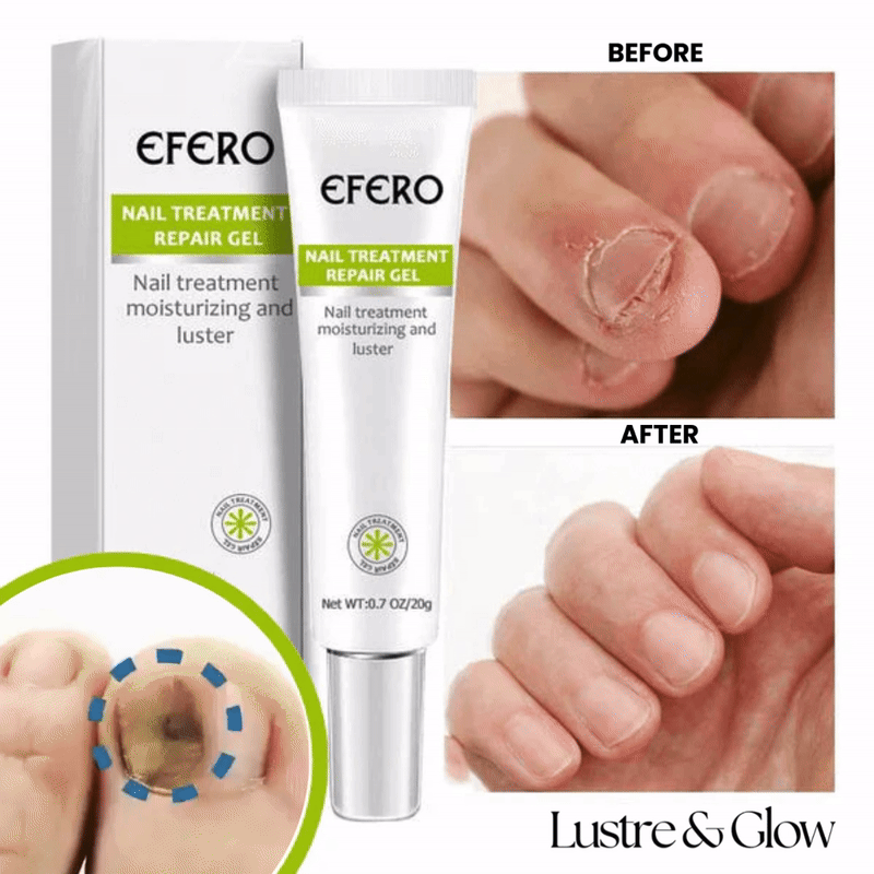 1+1 GRATIS | ZENVADA™ Nagelreparaturgel