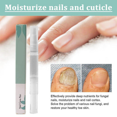 1 + 1 GRATIS | KeratiGlow™ | Bio-Nagelpflegestift
