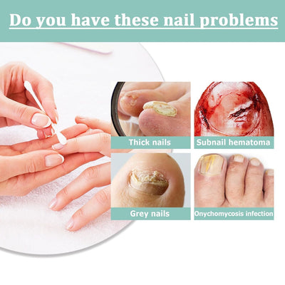 1 + 1 GRATIS | KeratiGlow™ | Bio-Nagelpflegestift