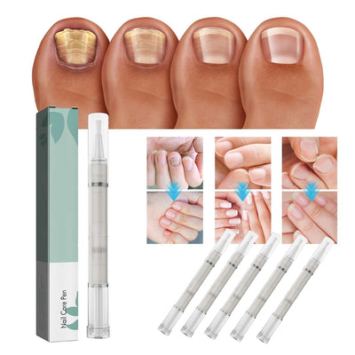 1 + 1 GRATIS | KeratiGlow™ | Bio-Nagelpflegestift