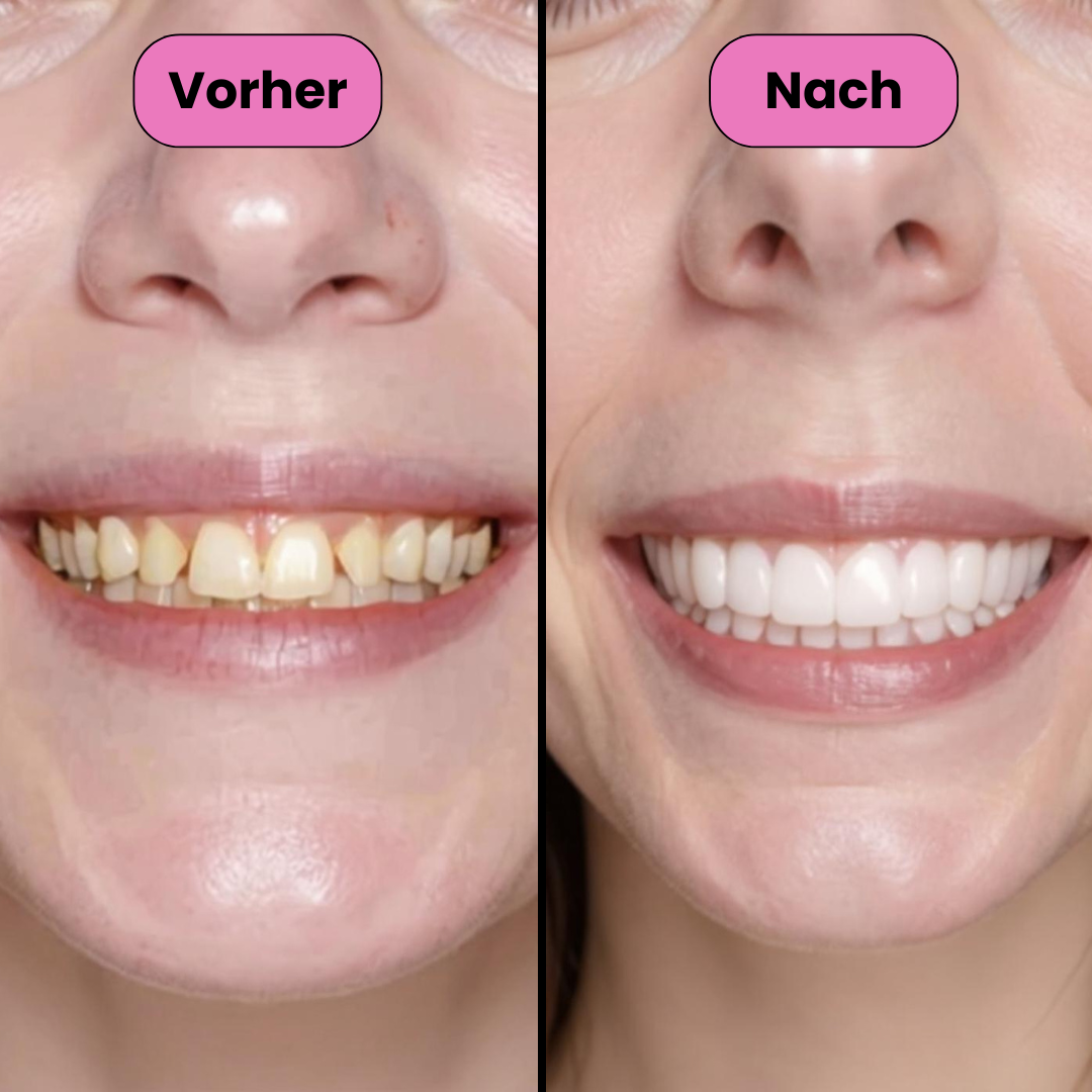 Ein Paar weißer künstlicher Zahnprothesen für Ober- und Unterkiefer, schwebend vor rosa Hintergrund